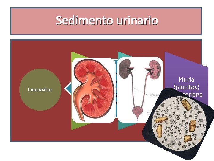 Sedimento urinario Leucocitos ü Varón normal, Pálidos, pequeñas Rojo o tumefactos, cantidades violeta movimientos
