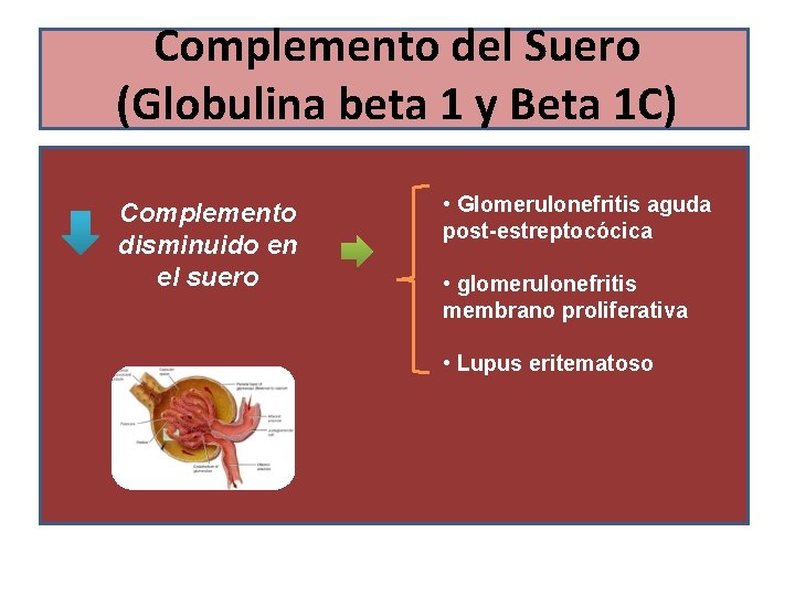 Complemento del Suero (Globulina beta 1 y Beta 1 C) Complemento disminuido en el