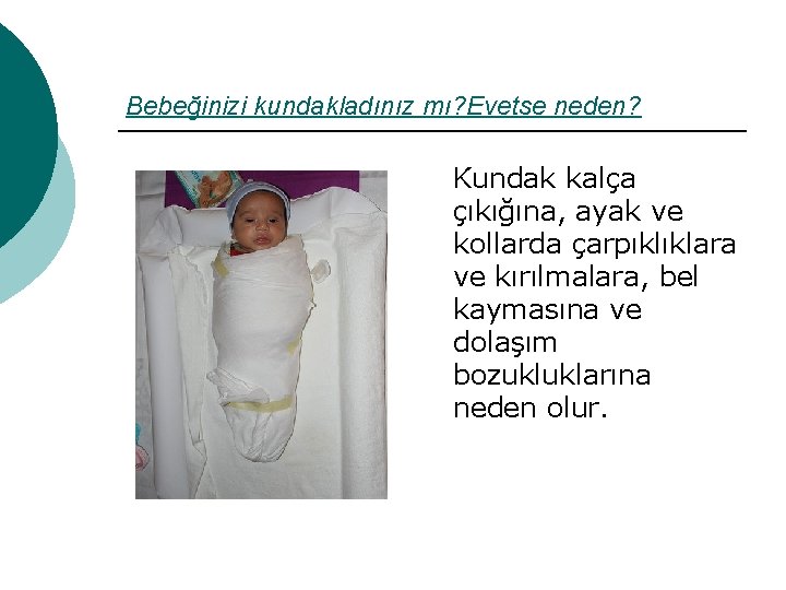 Bebeğinizi kundakladınız mı? Evetse neden? Kundak kalça çıkığına, ayak ve kollarda çarpıklıklara ve kırılmalara,