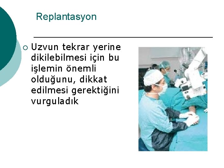 Replantasyon ¡ Uzvun tekrar yerine dikilebilmesi için bu işlemin önemli olduğunu, dikkat edilmesi gerektiğini