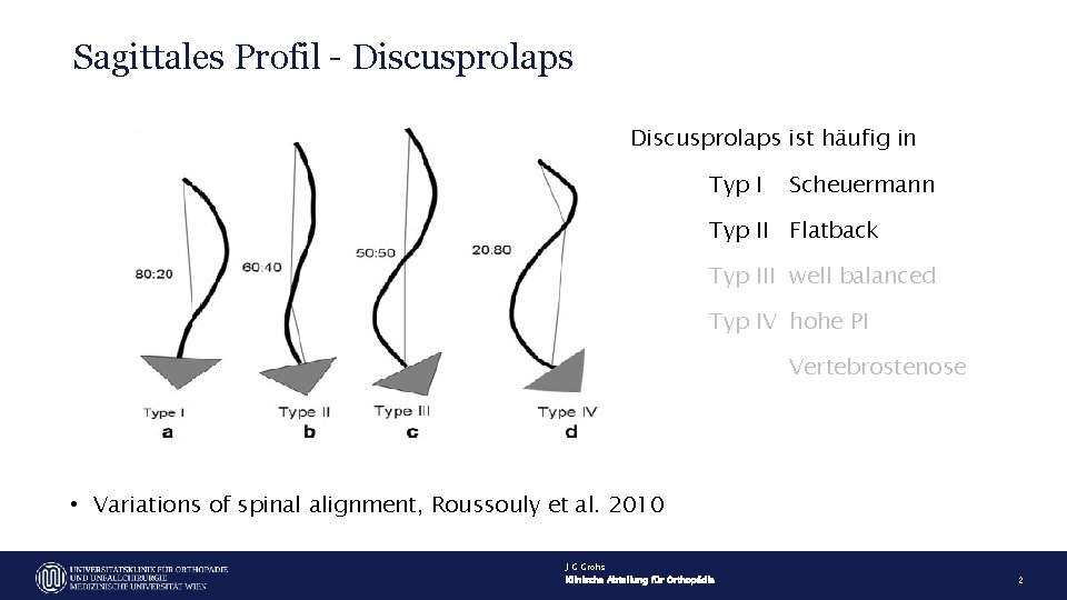 Sagittales Profil - Discusprolaps ist häufig in Typ I Scheuermann Typ II Flatback Typ