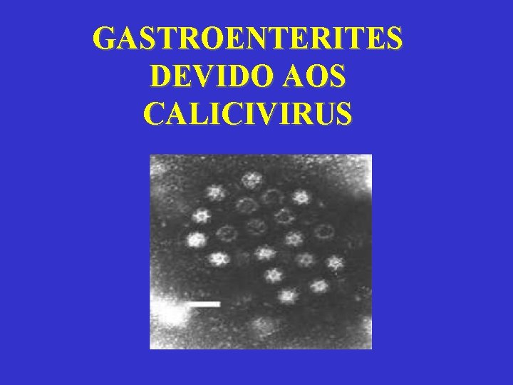 GASTROENTERITES DEVIDO AOS CALICIVIRUS 