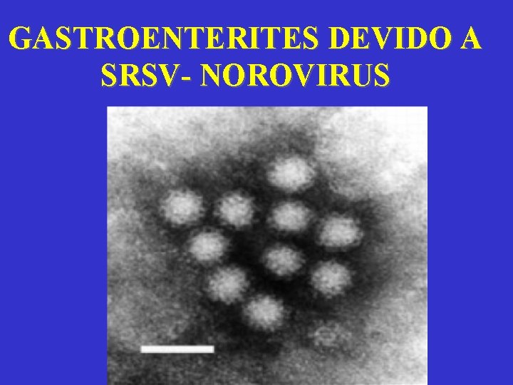 GASTROENTERITES DEVIDO A SRSV- NOROVIRUS 