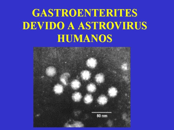 GASTROENTERITES DEVIDO A ASTROVIRUS HUMANOS 