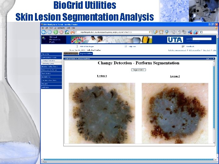 Bio. Grid Utilities Skin Lesion Segmentation Analysis 