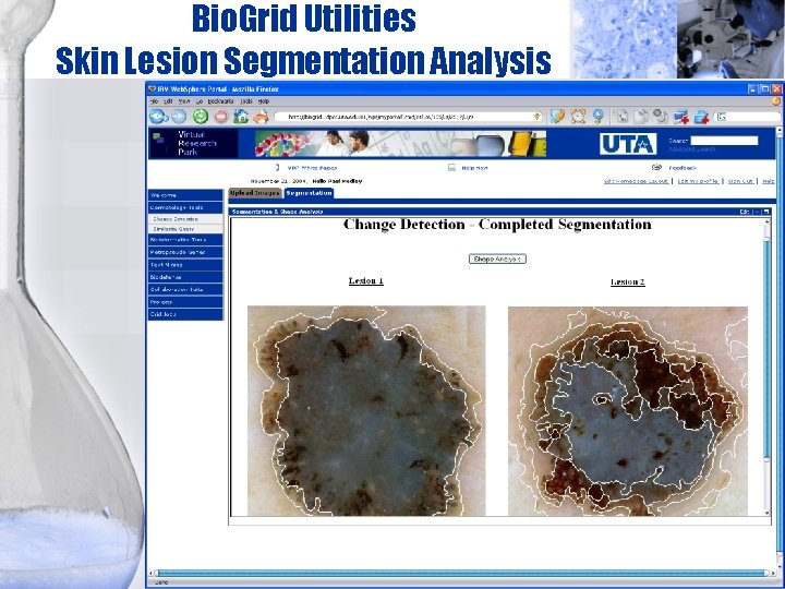 Bio. Grid Utilities Skin Lesion Segmentation Analysis 