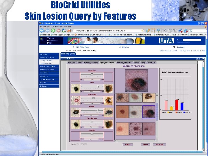 Bio. Grid Utilities Skin Lesion Query by Features 