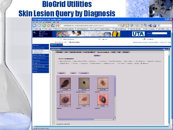 Bio. Grid Utilities Skin Lesion Query by Diagnosis 