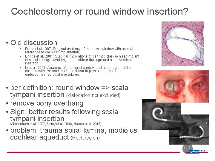 Cochleostomy or round window insertion? • Old discussion: • • • Franz et al.