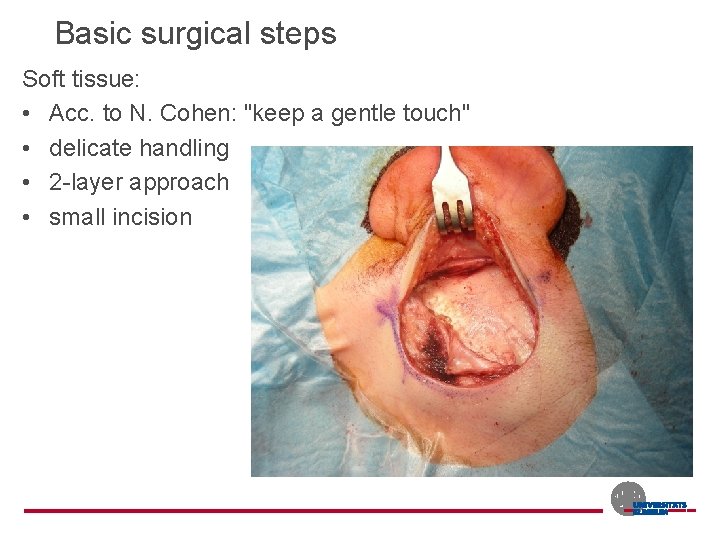 Basic surgical steps Soft tissue: • Acc. to N. Cohen: "keep a gentle touch"