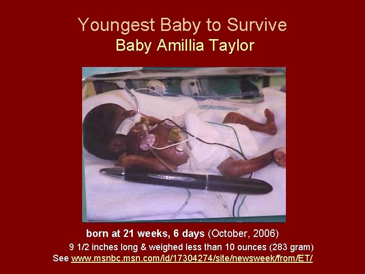 Youngest Baby to Survive Baby Amillia Taylor born at 21 weeks, 6 days (October,