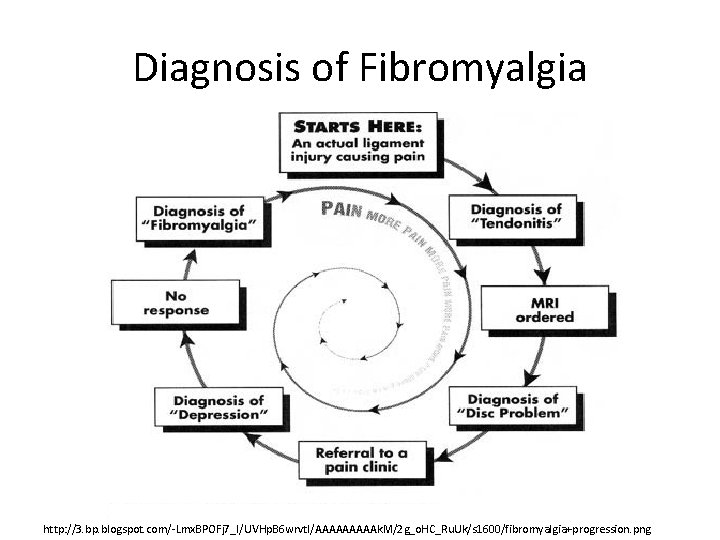 Diagnosis of Fibromyalgia http: //3. bp. blogspot. com/-Lmx. BPOFj 7_I/UVHp. B 6 wrvt. I/AAAAAk.