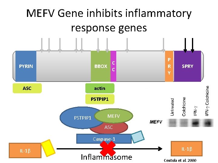 MEFV Gene inhibits inflammatory response genes C BBOX C PYRIN ASC P R Y