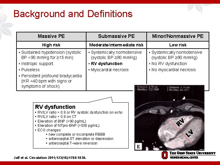 Background and Definitions Massive PE Submassive PE Minor/Nonmassive PE High risk Moderate/intermediate risk Low