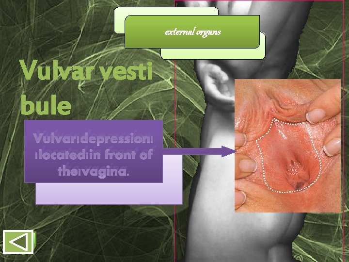 external organs Vulvar vesti bule Vulvar depression located in front of the vagina. 