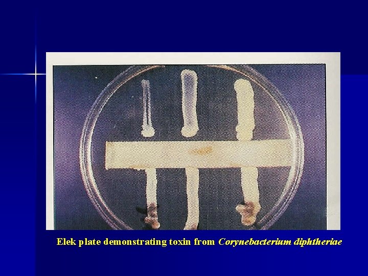 Elek plate demonstrating toxin from Corynebacterium diphtheriae 