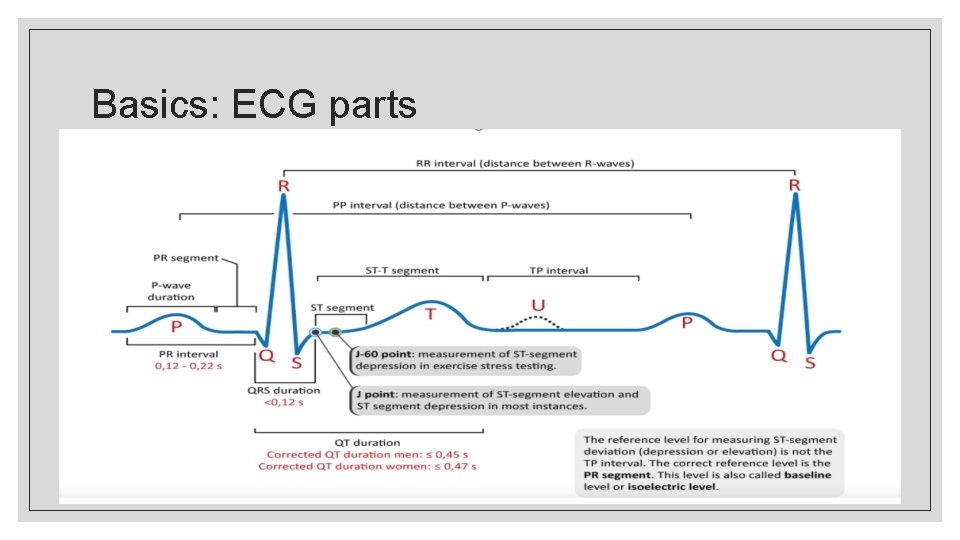 Basics: ECG parts 