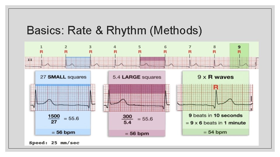 Basics: Rate & Rhythm (Methods) 