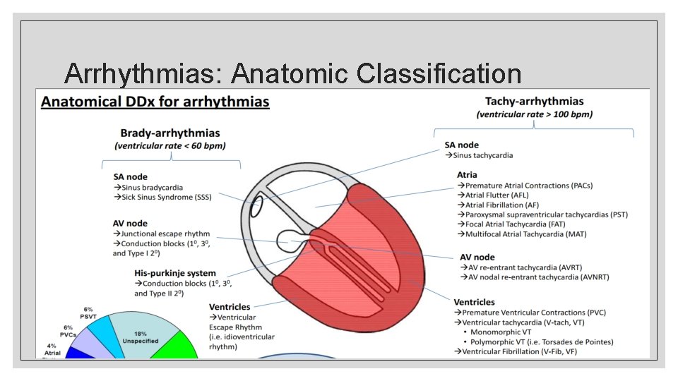 Arrhythmias: Anatomic Classification 