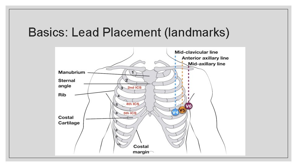 Basics: Lead Placement (landmarks) 