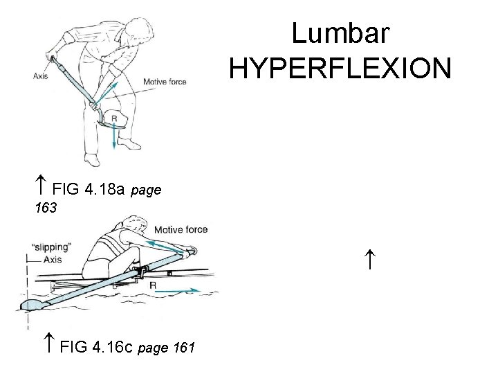 Lumbar HYPERFLEXION FIG 4. 18 a page 163 FIG 4. 16 c page 161