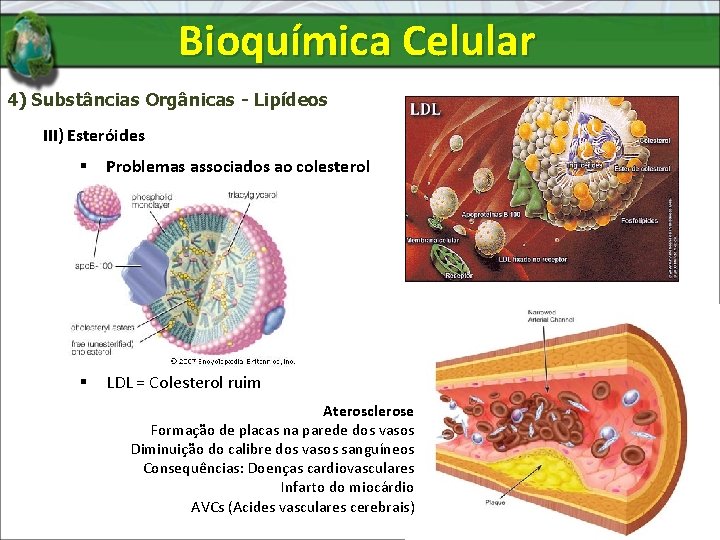 Bioquímica Celular 4) Substâncias Orgânicas - Lipídeos III) Esteróides § Problemas associados ao colesterol