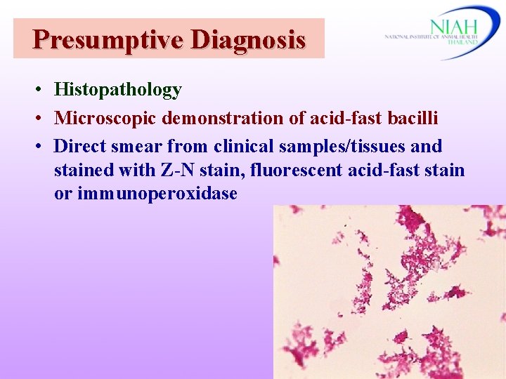 Presumptive Diagnosis • Histopathology • Microscopic demonstration of acid-fast bacilli • Direct smear from