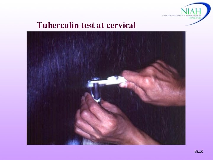 Tuberculin test at cervical NIAH 
