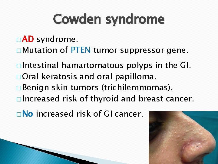 Cowden syndrome � AD syndrome. � Mutation of PTEN tumor suppressor gene. � Intestinal