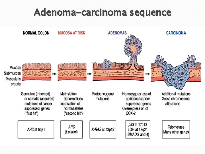 Adenoma-carcinoma sequence 