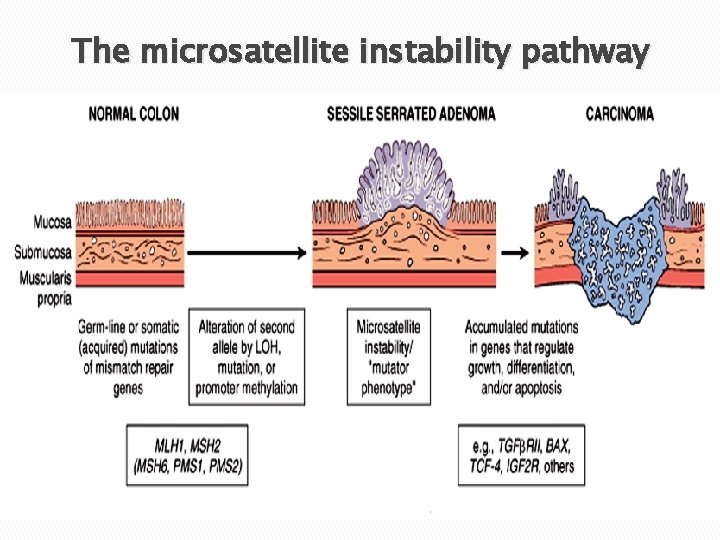 The microsatellite instability pathway 