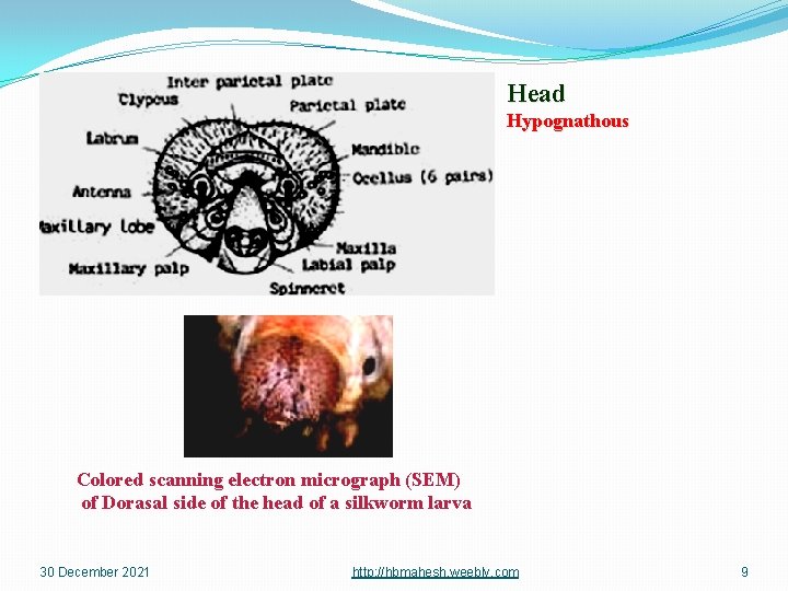 Head Hypognathous Colored scanning electron micrograph (SEM) of Dorasal side of the head of