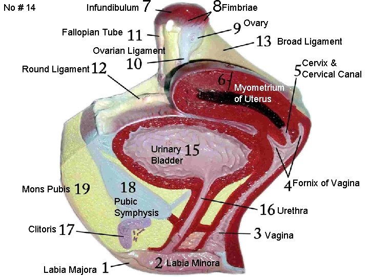 No # 14 Infundibulum 7 8 Fimbriae Ovary Fallopian Tube Broad Ligament Ovarian Ligament