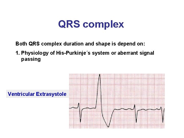 QRS complex Both QRS complex duration and shape is depend on: 1. Physiology of