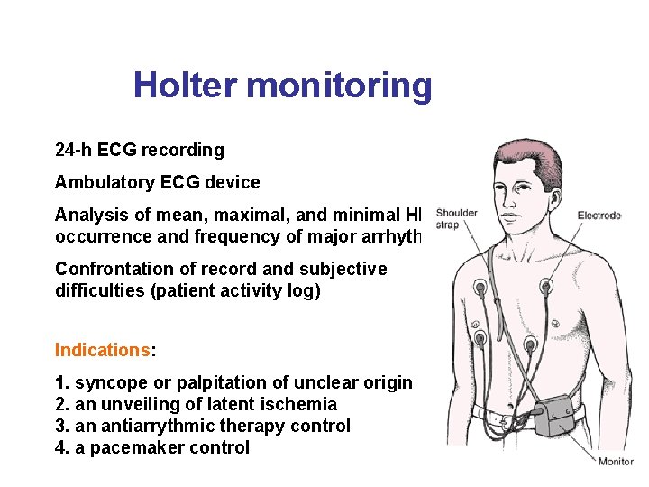Holter monitoring 24 -h ECG recording Ambulatory ECG device Analysis of mean, maximal, and