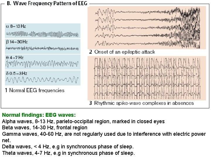 Normal findings: EEG waves: Alpha waves, 8 -13 Hz, parieto-occipital region, marked in closed