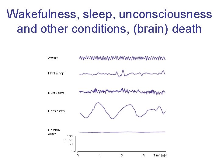 Wakefulness, sleep, unconsciousness and other conditions, (brain) death 