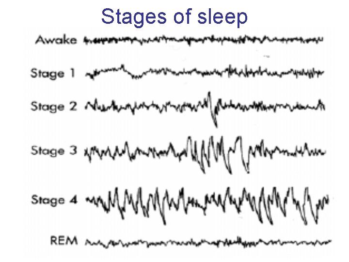 Stages of sleep 