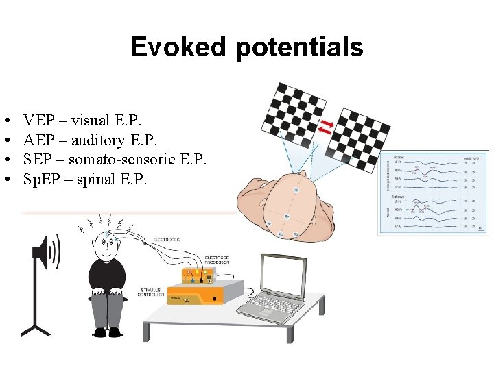Evoked potentials • • VEP – visual E. P. AEP – auditory E. P.