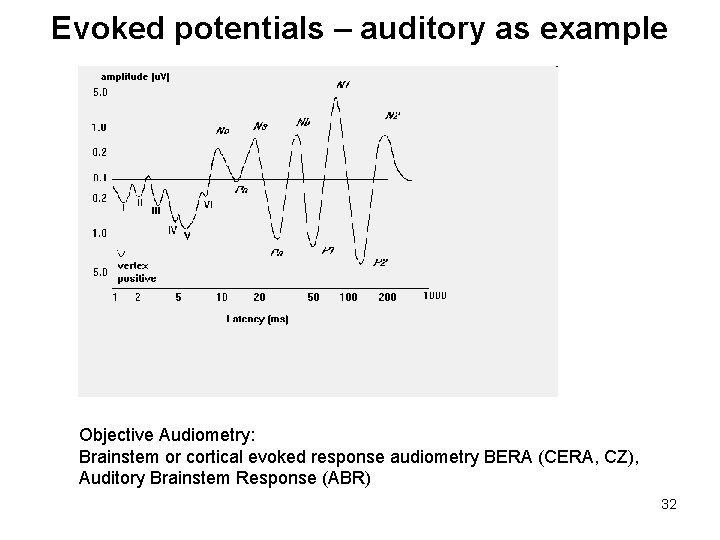 Evoked potentials – auditory as example Objective Audiometry: Brainstem or cortical evoked response audiometry