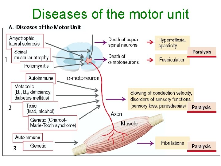 Diseases of the motor unit 