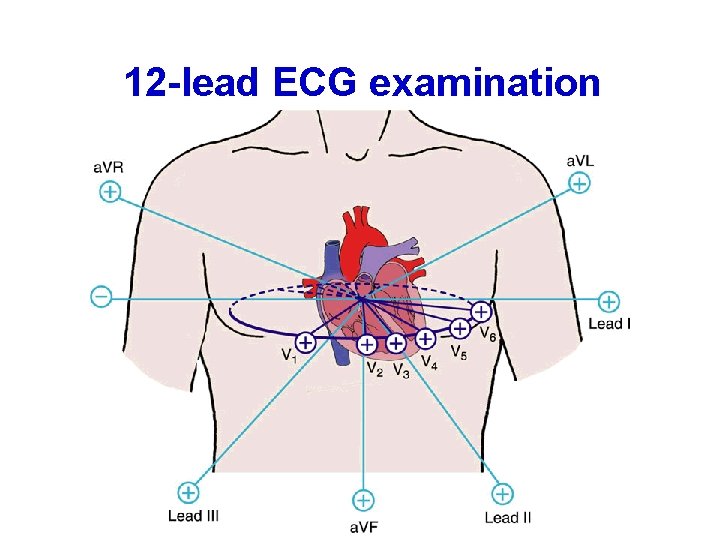 12 -lead ECG examination 