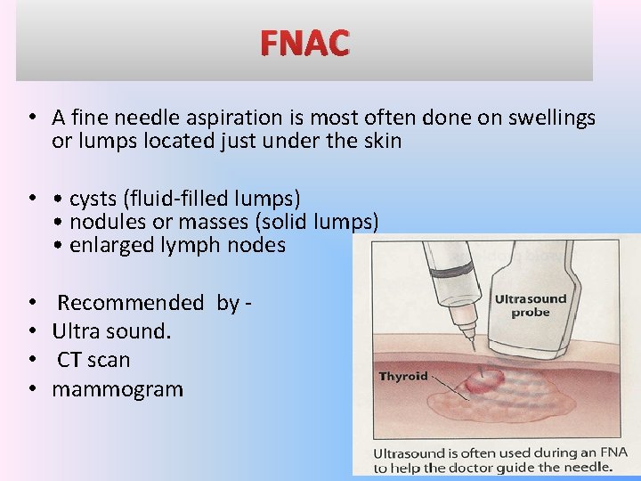 FNAC • A fine needle aspiration is most often done on swellings or lumps