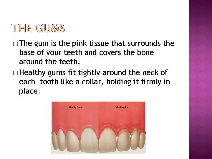 � The gum is the pink tissue that surrounds the base of your teeth