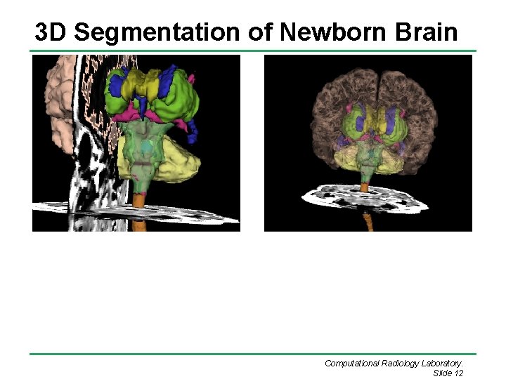 3 D Segmentation of Newborn Brain Computational Radiology Laboratory. Slide 12 3 D Segmentation of Newborn Brain Computational Radiology Laboratory. Slide 12