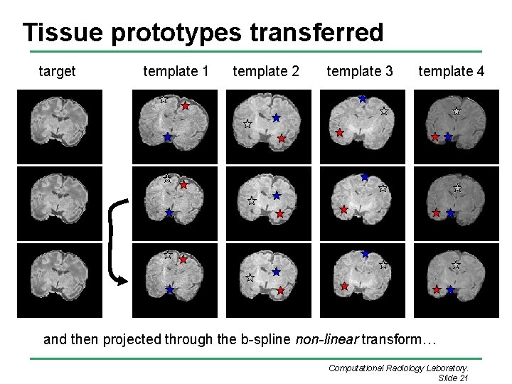Tissue prototypes transferred target template 1 template 2 template 3 template 4 and then Tissue prototypes transferred target template 1 template 2 template 3 template 4 and then