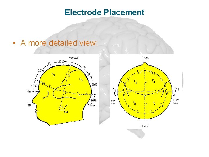 Electrode Placement • A more detailed view: 