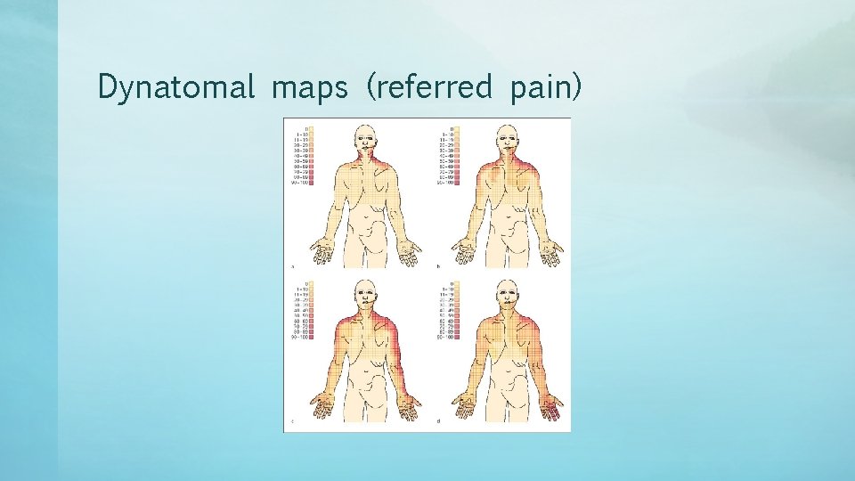 Dynatomal maps (referred pain) 