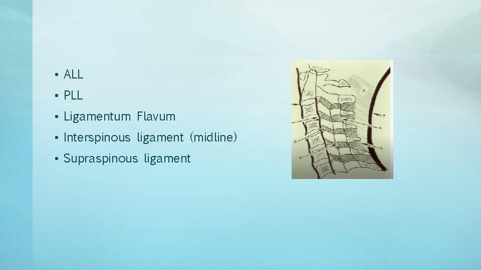  • ALL • PLL • Ligamentum Flavum • Interspinous ligament (midline) • Supraspinous