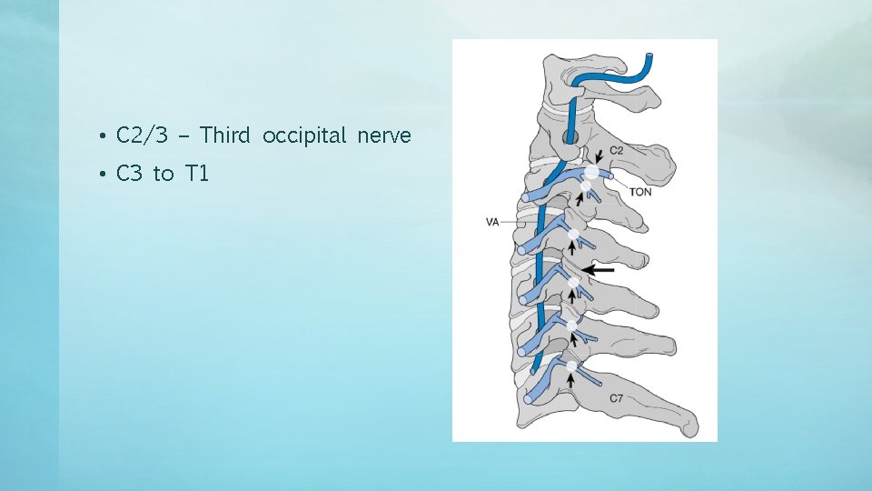  • C 2/3 – Third occipital nerve • C 3 to T 1